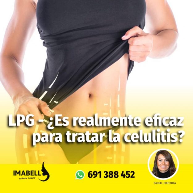 lpg tratamiento lpg