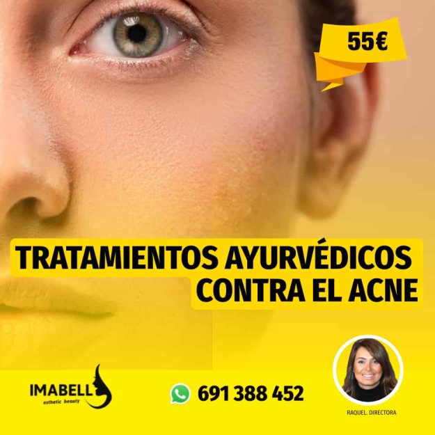 AYURVEDA CONTRA EL ACNE