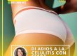 CELULITIS