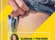 ELIMINAR LAS ESTRIAS