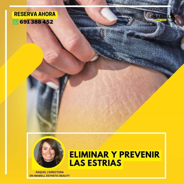 ELIMINAR LAS ESTRIAS